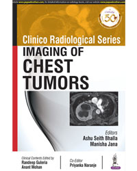 Clinico Radiological Series Imaging of Chest Tumors|1/e