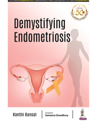 Demystifying Endometriosis|1/e