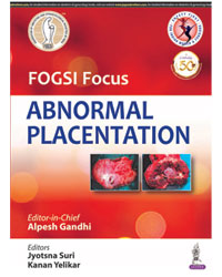 FOGSI Focus Abnormal Placentation|1/e