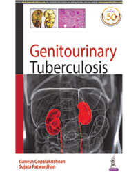 Genitourinary Tuberculosis|1/e