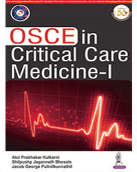 OSCE in Critical Care Medicine â€“ I|1/e