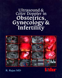 Ultrasound and Color Doppler in Obstetrics  Gynaecology and infertility with CD-ROM|1/e